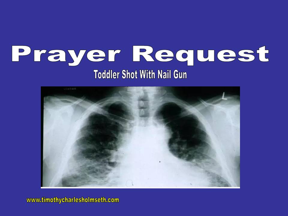 Prayer request toddler shot with wall gun.